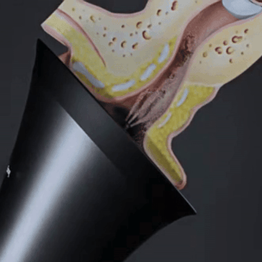 OhrRein Pro | Elektrisches Ohrwachs-Entfernungsset